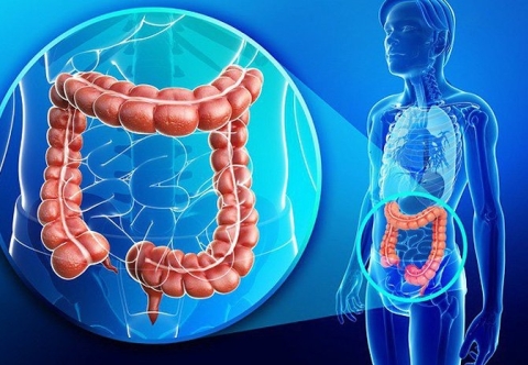 Ung thư đại tràng có nguy hiểm không